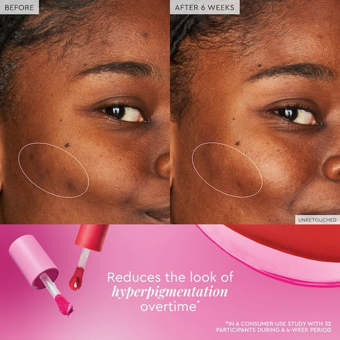 Watermelon Glow Niacinamide Dewy Flush - Brightening Serum Blush